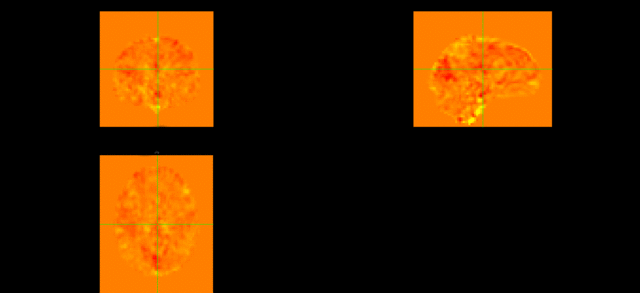 fMRI